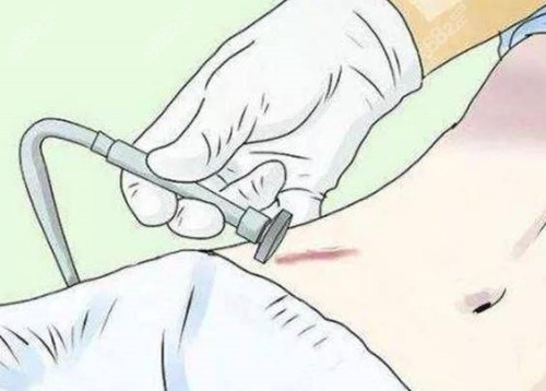 上海祛疤医院哪家好? 上海祛疤医院哪家好?