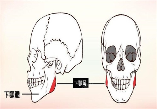 金柱翰做顴弓內推會術前進行3D模擬
