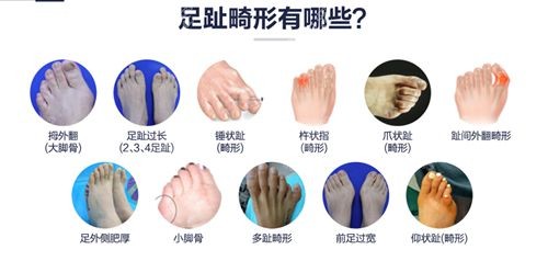 苏敬达个人简历介绍包含苏敬达擅长足部整形项目