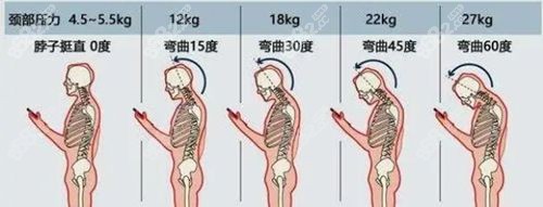 黄学峰一针消除富贵包价格多少