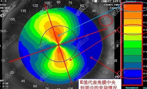 角膜屈度以数据