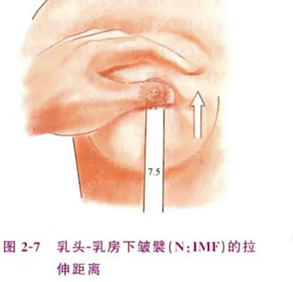 薛瑞隆胸预约挂号