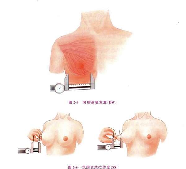 薛瑞整形医生怎么样