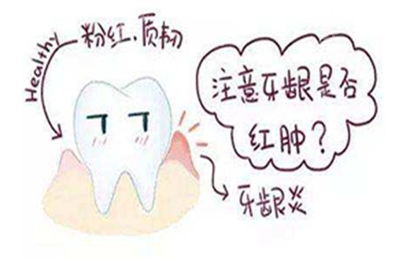 牙龈流水是怎么回事？