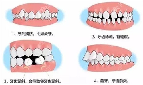 杭州马泷齿科牙齿矫正收费价格表公布