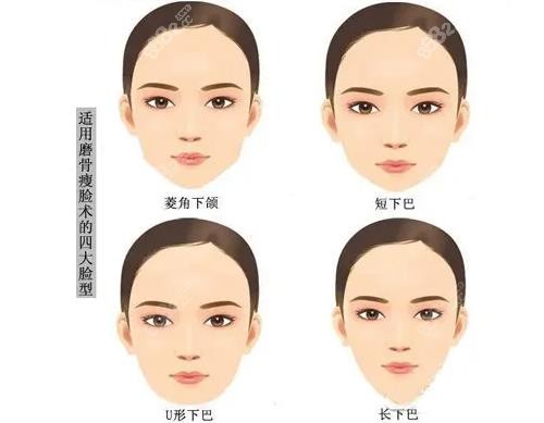 徐威强磨骨价格