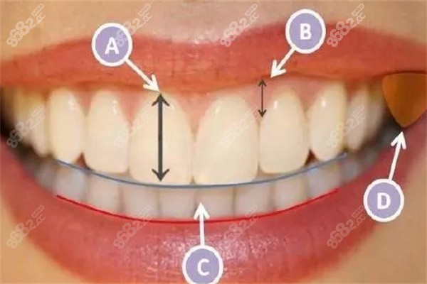 牙齿笑线美学