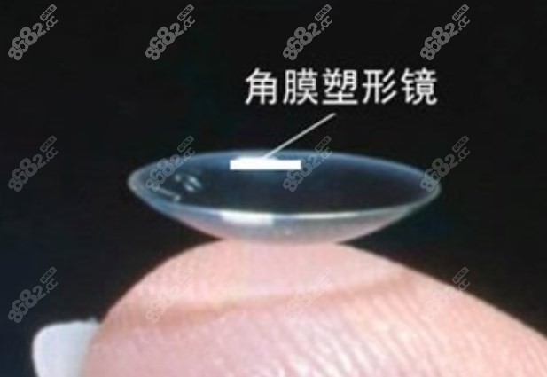 角膜塑形镜