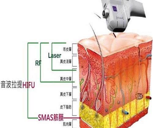 黄寅守面部提升多少钱