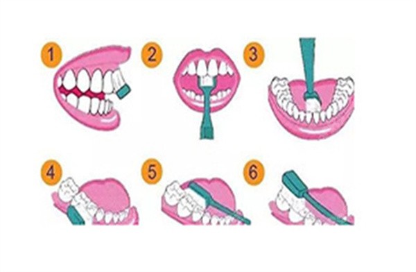 牙菌斑怎么治疗才能除根