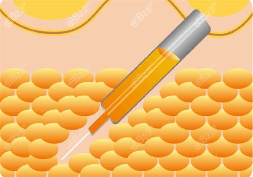 <!--<i data=20240705-sp></i>-->蒲小兵手術做得好