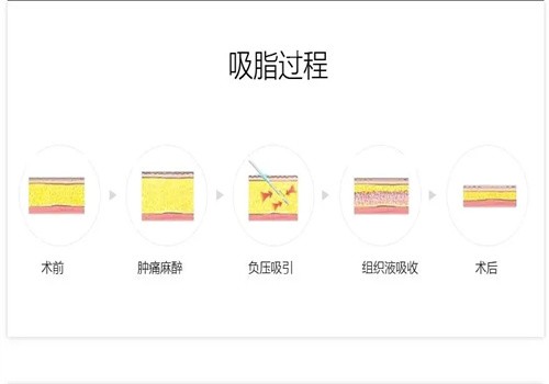 <!--<i data=20240705-sp></i>-->蒲小兵手術做得好