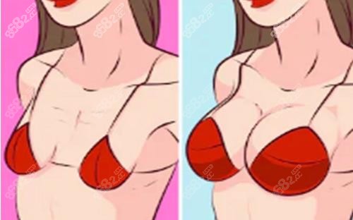 成都薛瑞胸部為什么那么貴