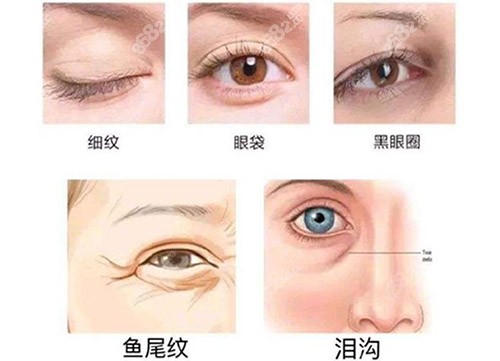 眼部衰老问题
