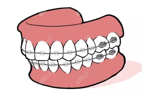 广州三仁口腔医院做牙齿矫正技术成熟