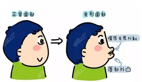 不及时牙齿矫正的危害图解.jpg