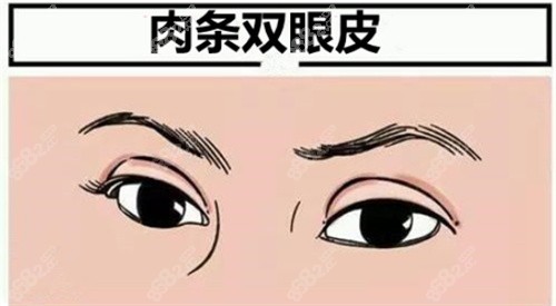 肉条眼