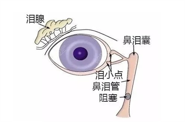YAG激光