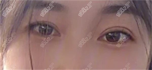 广州爱尔眼科医院