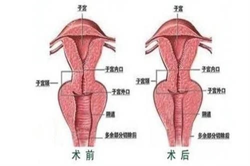阴道结构图