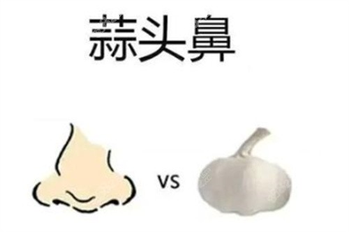 鼻子对比图