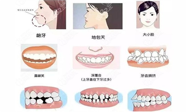 牙套脸不戴牙套了能恢复吗