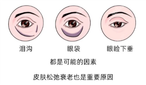 眼部衰老出现的问题图解