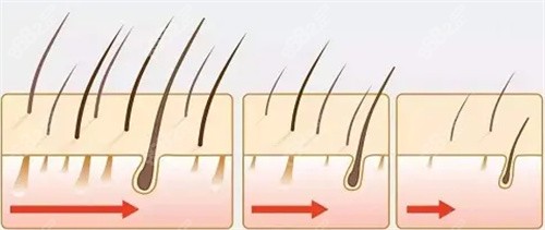 毛發(fā)生長動畫圖 毛發(fā)生長動畫圖