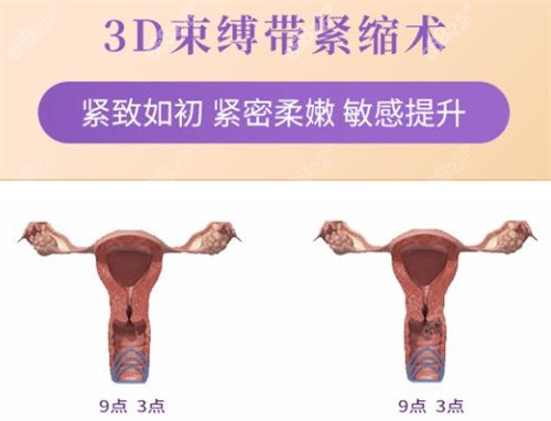 北京嘉禾医院3D生物束带