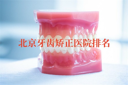 北京牙齿矫正医院排名：禾禾/圣贝/劲松是整牙推荐好医院！