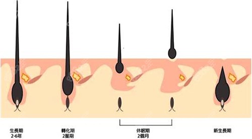 毛发生长周期漫画图