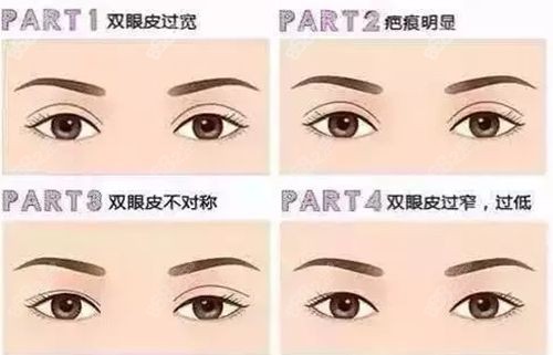 北京史迎军眼修复怎么样