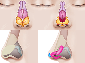 鼻子结构示意图