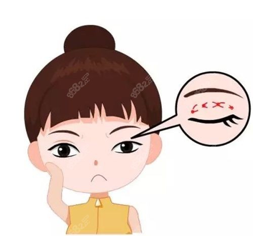 史迎军眼修复范例对比照