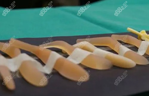 隆鼻硅胶照片