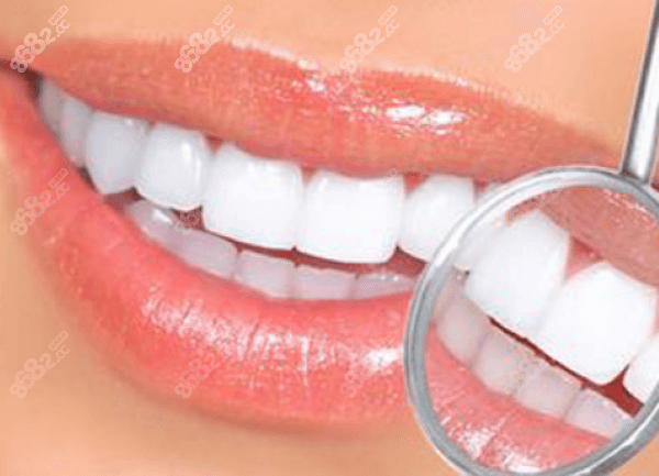 北京极简口腔医院牙齿美白收费标准