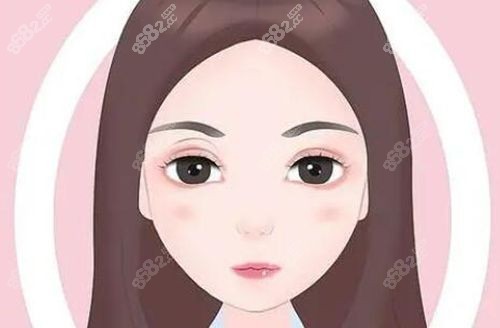 来成都纯曦做双眼皮手术