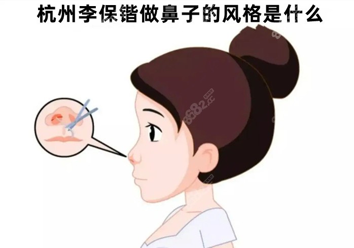 杭州李保鍇醫(yī)生做鼻子風格是什么