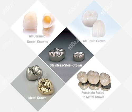 泰康拜博口腔醫(yī)院牙齒修復(fù)價目表 泰康拜博口腔醫(yī)院牙齒修復(fù)價目表