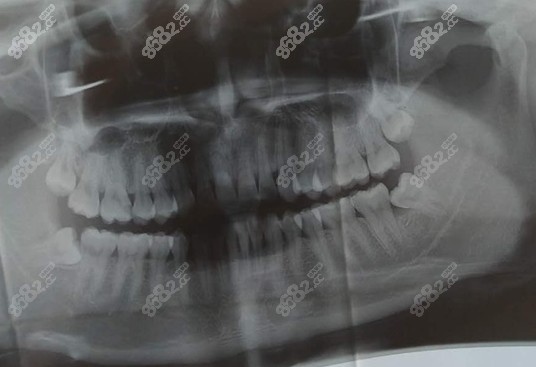 口腔ct照片