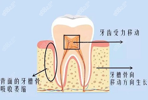 牙齿牙龈展示图照片