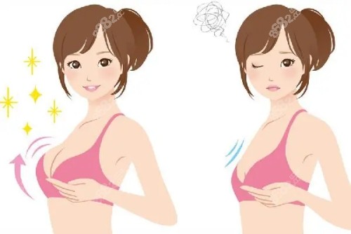 乳房下垂悬吊提升双环和棒棒糖手术有哪些区别？
