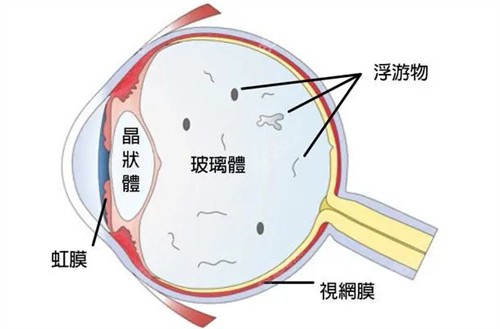 眼球结构图.jpg