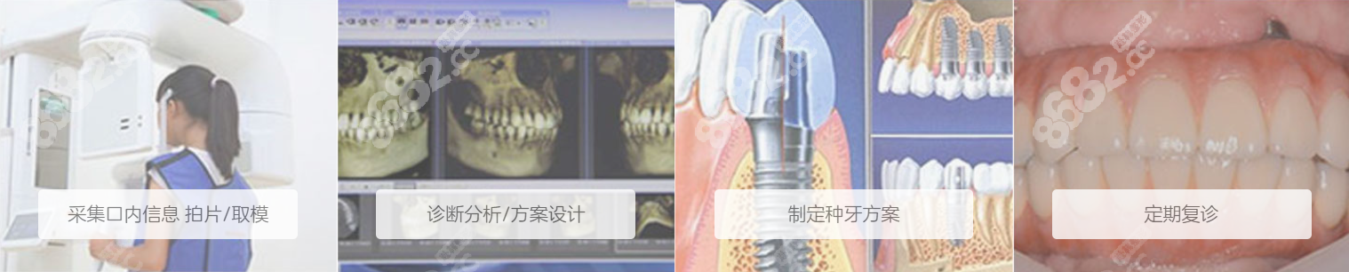 佛山拜博口腔种植牙怎么样