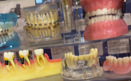 成都新桥口腔连锁牙齿模型实拍图