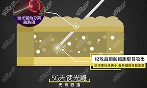 天使光雕