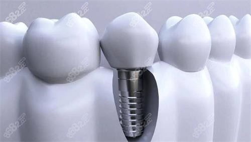 微信截图_20231219144112.png