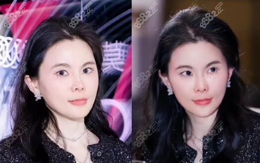 杭州幼態(tài)臉醫(yī)院有名的醫(yī)生:蔣錚錚