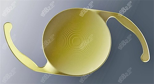 20240322148038.jpg 白内障晶体图示.jpg