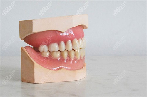牙齿模型.jpg